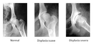 raio x de displasia coxofemoral